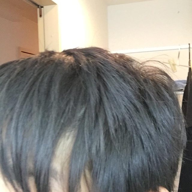 ハゲ祭り 代前半でハゲるなんj民 ハゲ祭り ハゲろぐ