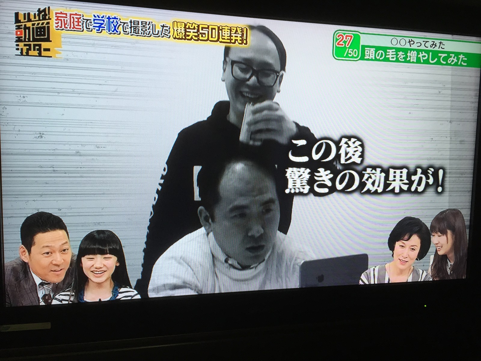トレエン斉藤さんが全力で髪の毛を増やしてみた結果ｗｗｗｗｗｗｗ ハゲルヤ ハゲと向き合うウェブマガジン