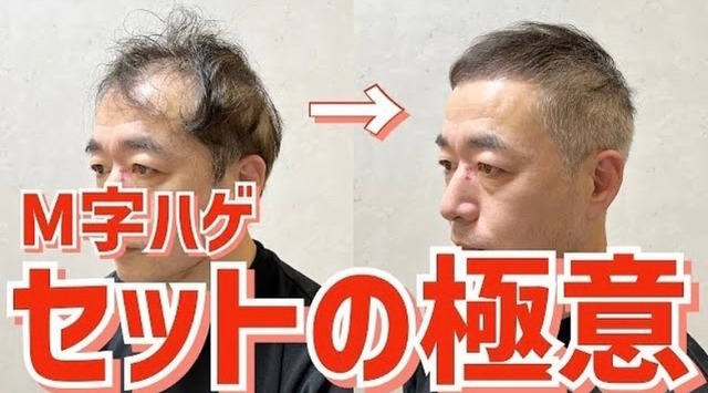 ビフォーアフター02