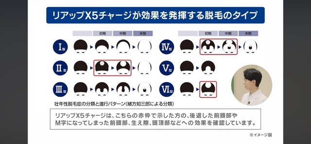 LINE_ALBUM_20250919_250919_4