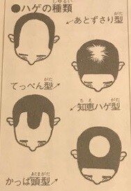 どうして人間はハゲるのか 小学生向けの学習書が攻めまくってる ハゲルヤ ハゲと向き合うウェブマガジン どうして人間はハゲるのか 小学生向けの学習書が攻めまくってる ハゲルヤ ハゲと向き合うウェブマガジン