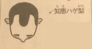 知恵ハゲ型