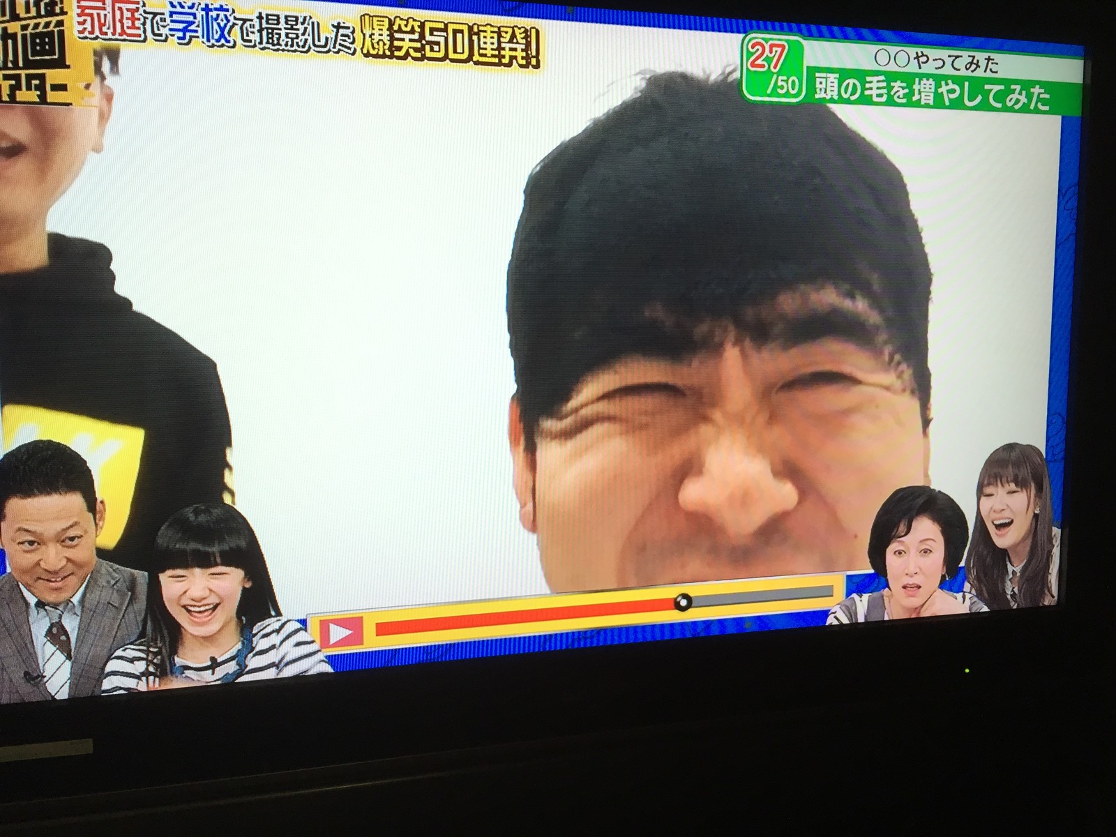 トレエン斉藤さんが全力で髪の毛を増やしてみた結果ｗｗｗｗｗｗｗ ハゲルヤ ハゲと向き合うウェブマガジン