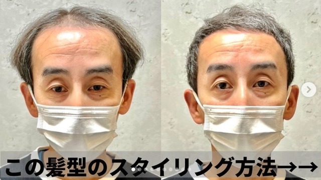 ビフォーアフター04