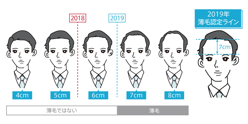 19年 ハゲの境界線は眉毛から7cm 昨年より寛容な結果に ハゲルヤ ハゲと向き合うウェブマガジン 19年 ハゲの境界線は眉毛から7cm 昨年より寛容な結果に ハゲルヤ ハゲと向き合うウェブマガジン