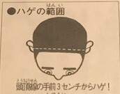 ハゲの範囲