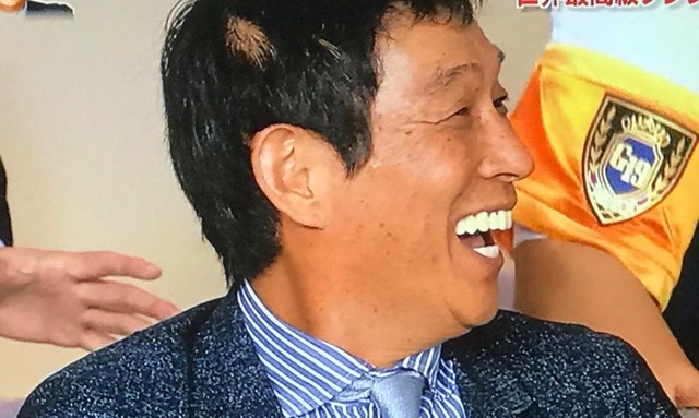 お笑い怪獣 明石家さんまの 10円ハゲ がテレビに映り込む事故発生 ハゲルヤ ハゲと向き合うウェブマガジン お笑い怪獣 明石家さんまの 10円ハゲ がテレビに映り込む事故発生 ハゲルヤ ハゲと向き合うウェブマガジン