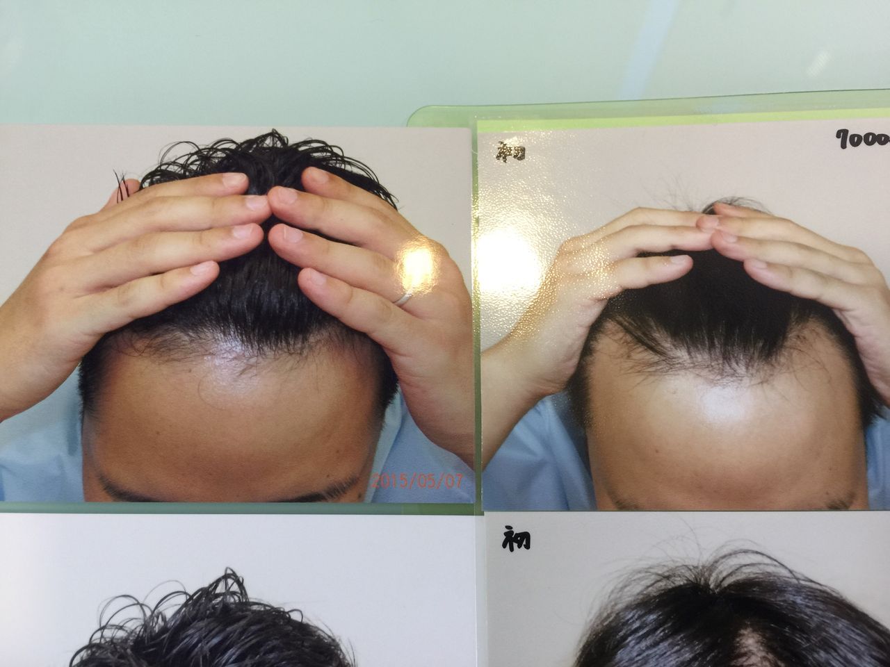 バルクオム社長の野口卓也氏 Googleから 日本一の若ハゲ と認定されながらもフサフサに ハゲルヤ ハゲと向き合うウェブマガジン