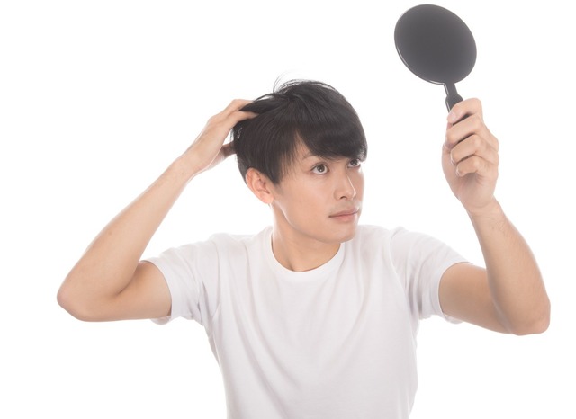 爽やかハゲ