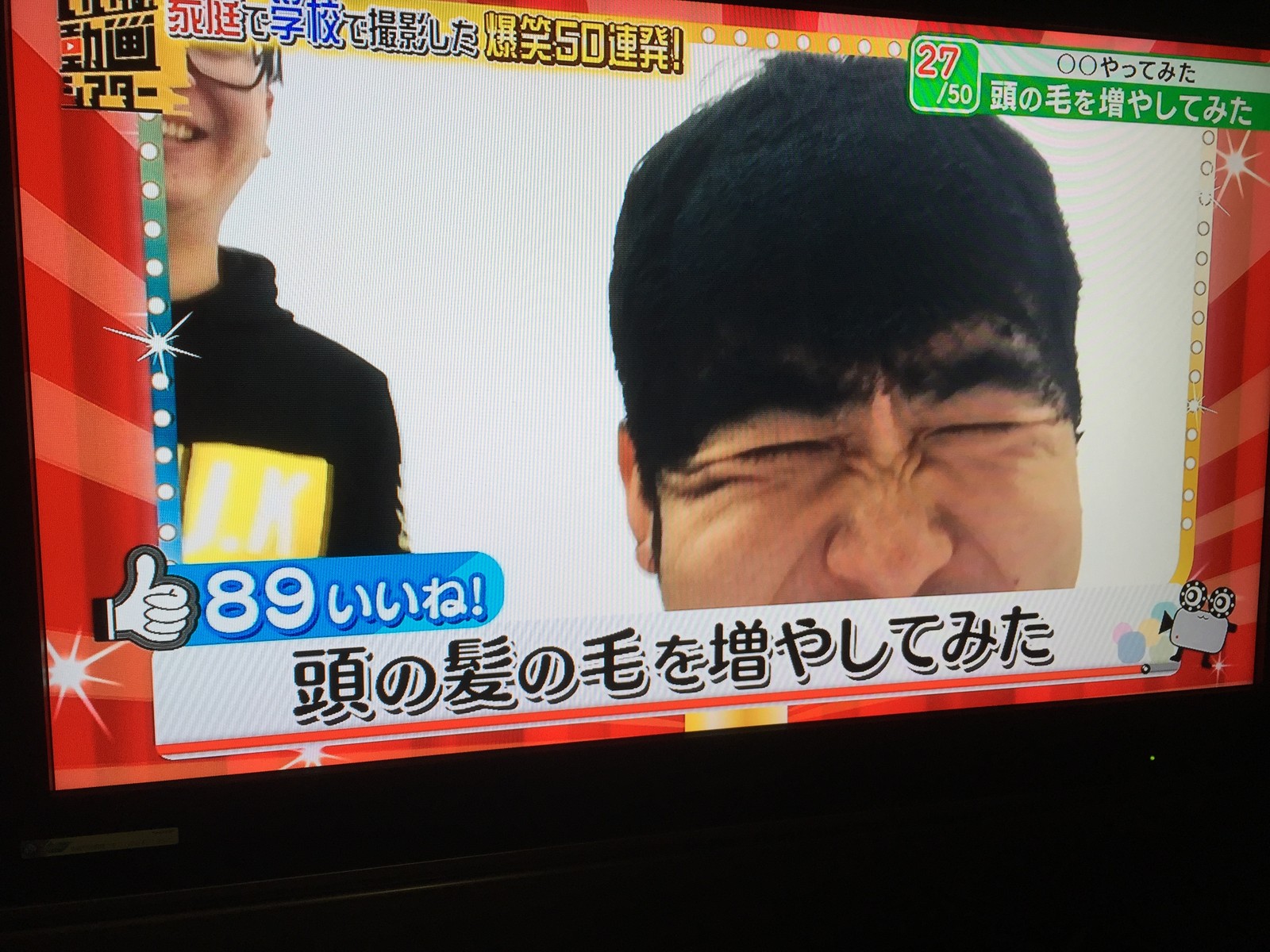 トレエン斉藤さんが全力で髪の毛を増やしてみた結果ｗｗｗｗｗｗｗ ハゲルヤ ハゲと向き合うウェブマガジン