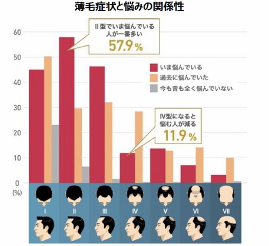 男性の52 9 が薄毛に悩むも 頭頂部がハゲると悩まなくなることが判明 ハゲルヤ ハゲと向き合うウェブマガジン 男性の52 9 が薄毛に悩むも 頭頂部がハゲると悩まなくなることが判明 ハゲルヤ ハゲと向き合うウェブマガジン