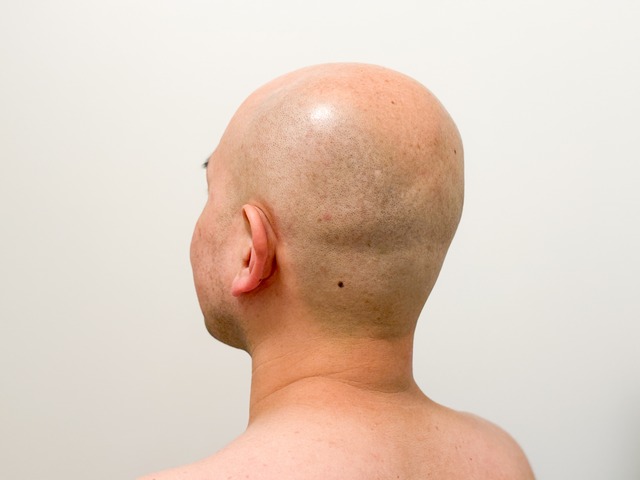 33788380_m