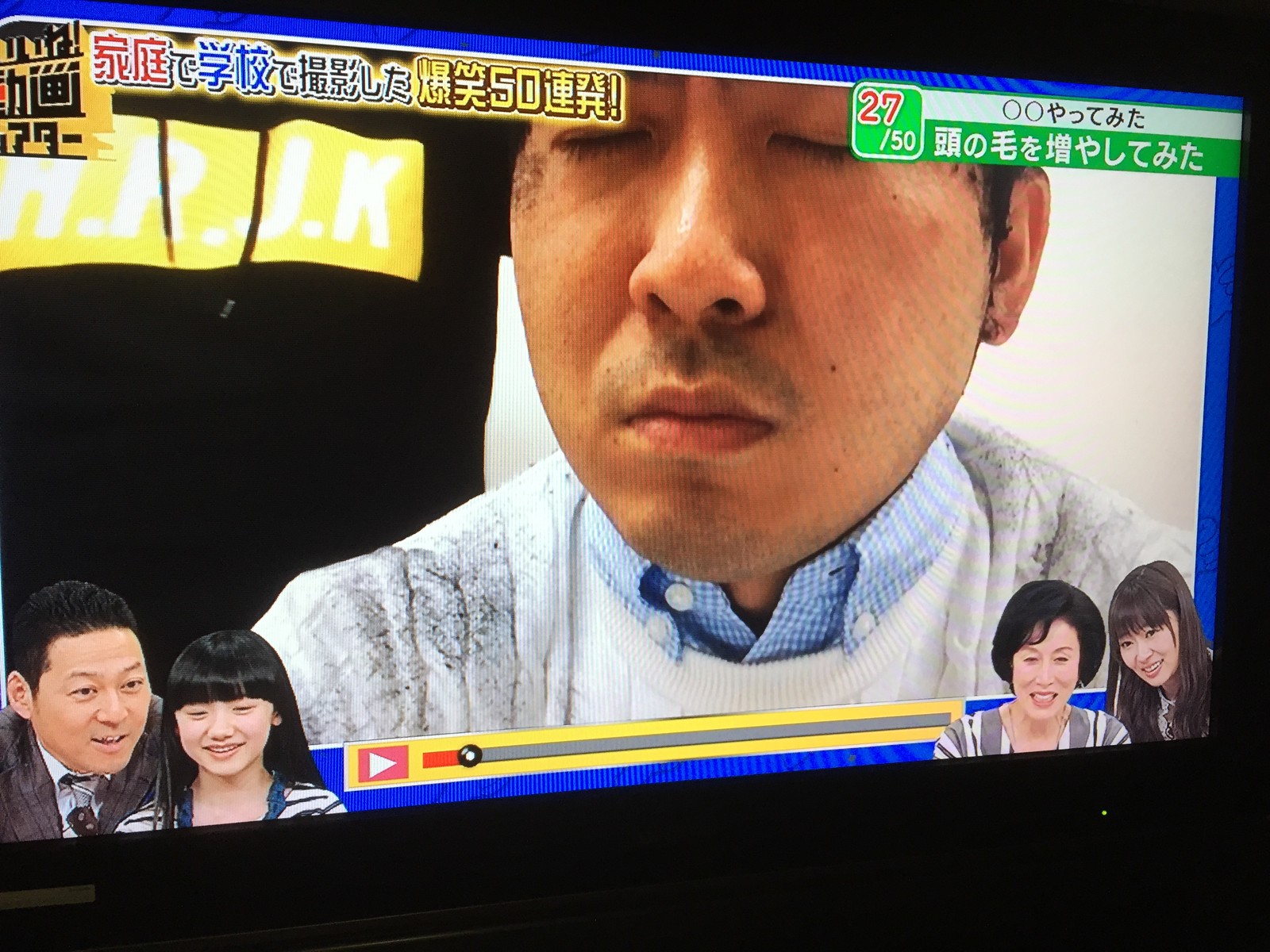 トレエン斉藤さんが全力で髪の毛を増やしてみた結果ｗｗｗｗｗｗｗ ハゲルヤ ハゲと向き合うウェブマガジン