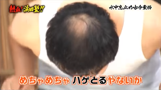 岩尾ハゲ