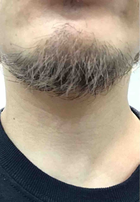 FullSizeRender