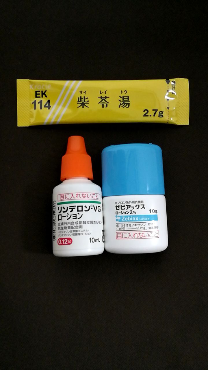 植毛後の皮膚科4回目 内服と外用薬 韓流なる植毛 M字 生え際を植毛