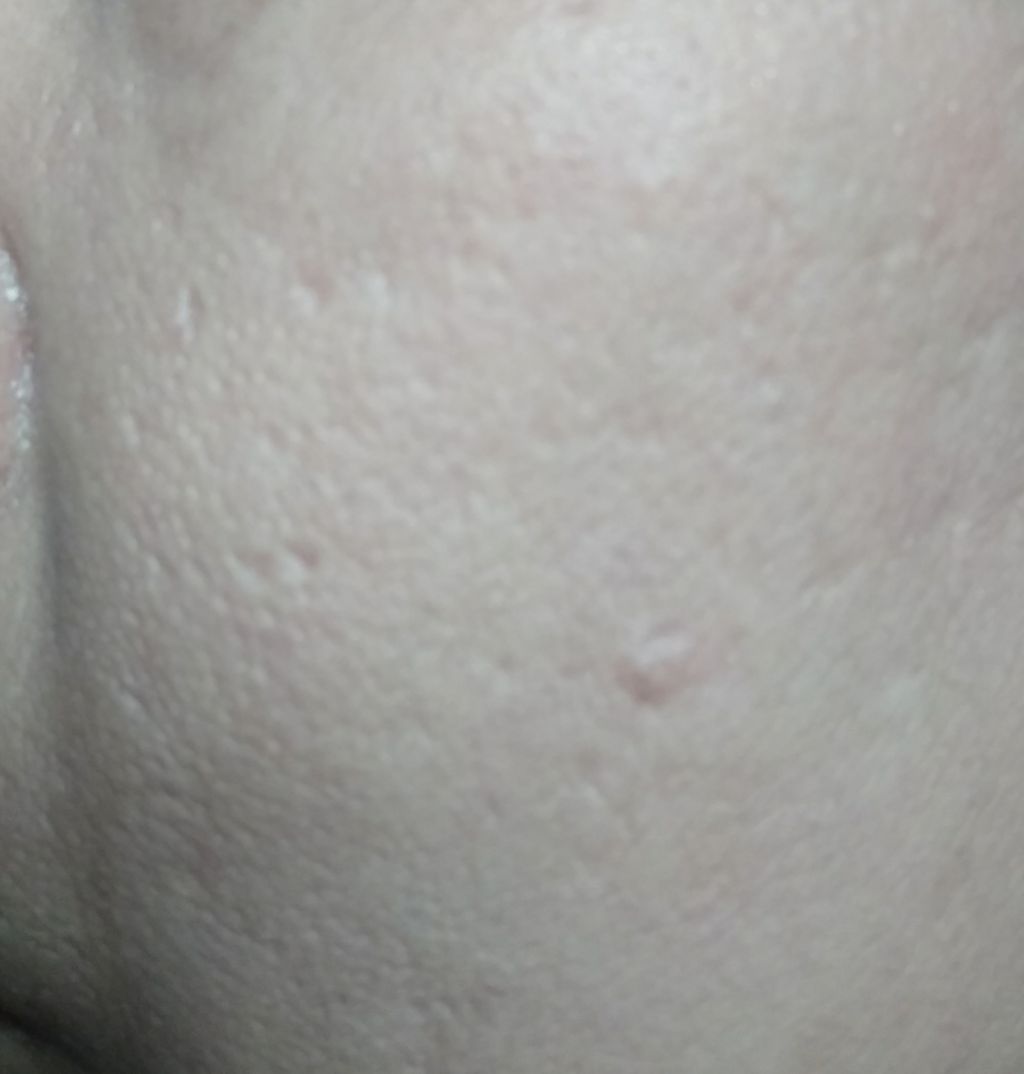 凸凹クレーターにたるみ毛穴が目立つ婆が厚塗りすると見苦しい 分かっていてもつい塗りたくってしまう 汚くなるだけなのに 絶望的なレベルのクレーター婆のイライラを吐き出すブログ