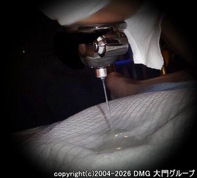 ブリーフ紳士の拡張改造調教(中編)【DMG大門 Essence\'s Ｓ ブログ】