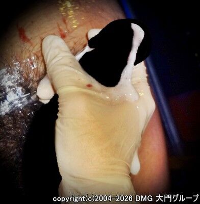 ブルママニアのお仕置き拷問(後編)【DMG大門 Essence\'s Ｓ ブログ】