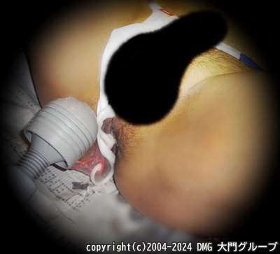 ビキニの中に潜む敏感亀頭【DMG大門 Essence\'s Ｓ ブログ】