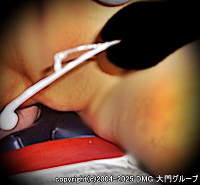 ドM堕ち必至の監禁凌辱調教【DMG大門 Essence\'s Ｓ ブログ】