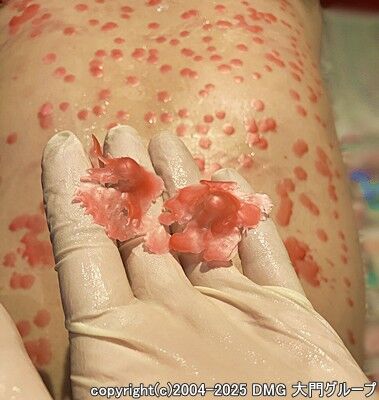 全身そして乳首やチ○ポへ、緊縛乳首拷問定期調教で蝋燭まみれ②【DMG大門 Essence\'s Ｓ ブログ】