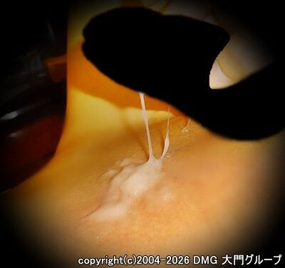 成果を見せる拡張訓練中アナル【DMG大門 Essence\'s Ｓ ブログ】