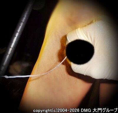 強制開門にて目覚める羞恥責めの快感【DMG大門 Essence\'s Ｓ ブログ】