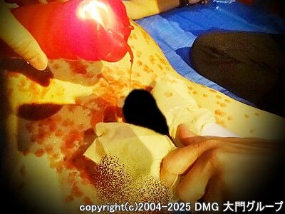 蝋燭４本責めのメインディッシュ、全身性感帯Ｍ４時間コース（４／４）【DMG大門 Essence\'s Ｓ ブログ】