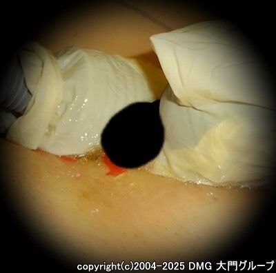 灼熱地獄に堕とされた変態紳士【DMG大門 Essence\'s Ｓ ブログ】