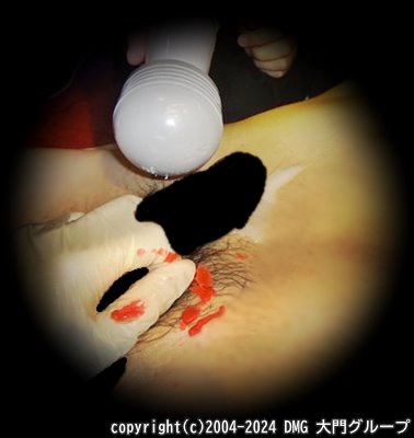 亀頭を覆う灼熱の蝋燭【DMG大門 Essence\'s Ｓ ブログ】