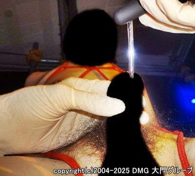 局部拷問を乗り越えて【DMG大門 Essence\'s Ｓ ブログ】