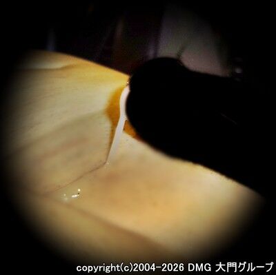 ダブルフィストで種汁失禁【DMG大門 Essence\'s Ｓ ブログ】