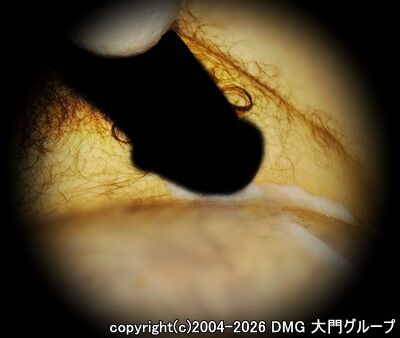 粘液漬けで犯される快感【DMG大門 Essence\'s Ｓ ブログ】
