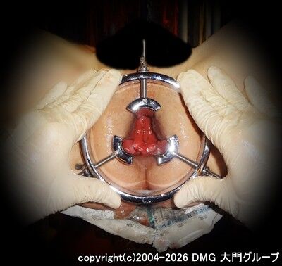 強制開門器具による恥辱観察プレイ【DMG大門 Essence\'s Ｓ ブログ】