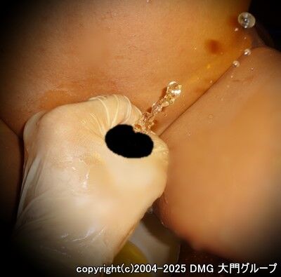 快楽局部拷問で悶絶潮噴き達成【DMG大門 Essence\'s Ｓ ブログ】