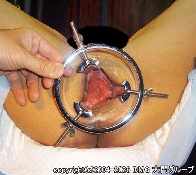 強制開門で露わとなる奥の穴【DMG大門 Essence\'s Ｓ ブログ】