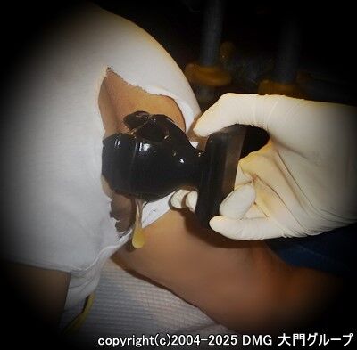 変態紳士のお気に入りプレイグッズ【DMG大門 Essence\'s Ｓ ブログ】