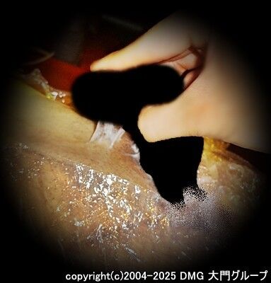 拷問達成のご褒美はマミフィケーションプレイ【DMG大門 Essence\'s Ｓ ブログ】