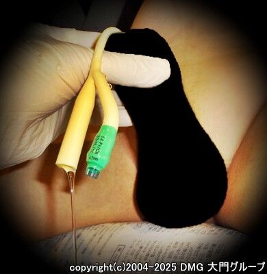 達成感溢れる尿道貫通【DMG大門 Essence\'s Ｓ ブログ】