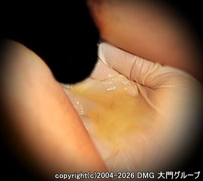 絶叫必至の搾精地獄【DMG大門 Essence\'s Ｓ ブログ】