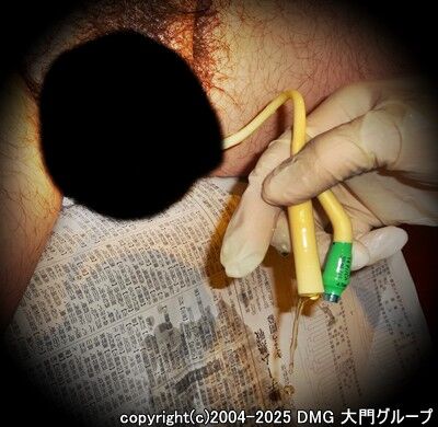 縄酔いフェチの尿道完全貫通【DMG大門 Essence\'s Ｓ ブログ】