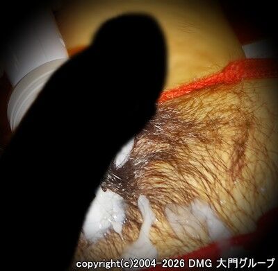 感度開発で変態堕ちするM【DMG大門 Essence\'s Ｓ ブログ】