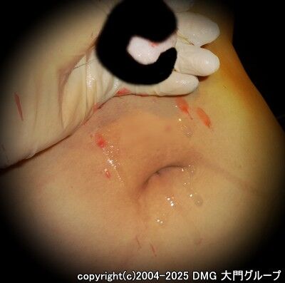 苦痛と快楽の改造調教(後編)【DMG大門 Essence\'s Ｓ ブログ】