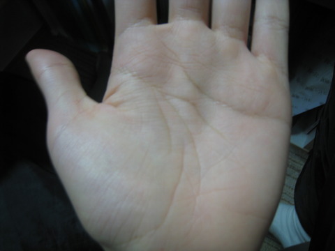tesou