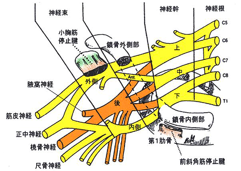 brachial_plexus_injury