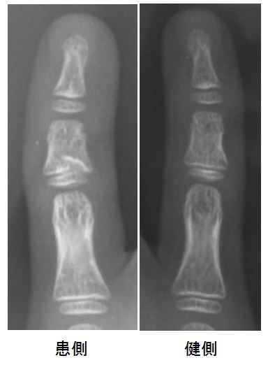 SH type 5 - コピー