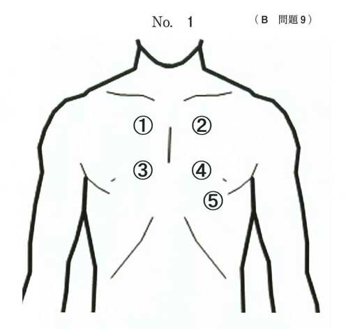 医師国家試験問題を解こう 119B9 大動脈弁狭窄症（AS） | 医師