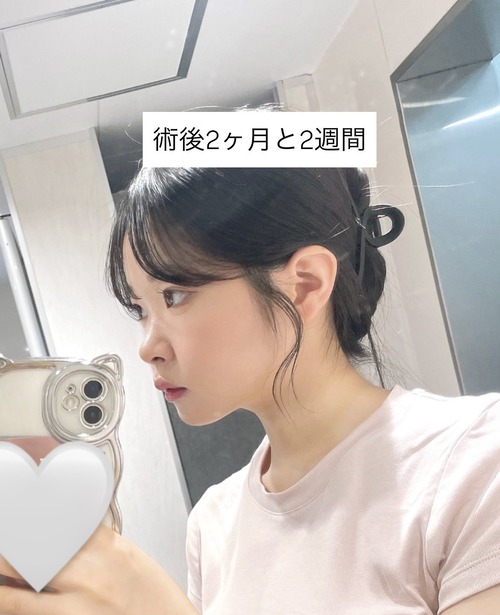 Gu7y-uya0AAnNAB