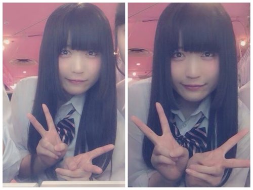 【整形ビフォーアフター】美少女女子高生が１０００万円かけて整形した努力顔　公開される